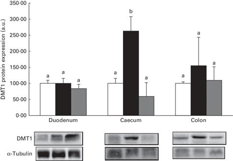 Protein Expression Levels Of Divalent Metal Transporter Dmt In The