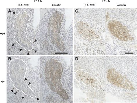 Figure From A Role Of Cxc Chemokine Ligand Stromal Cell Derived