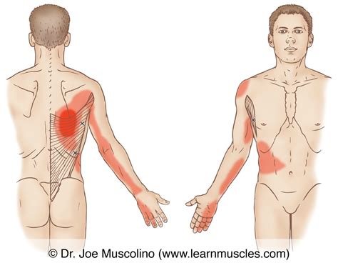 Latissimus Dorsi Lat Trigger Points Learn Muscles