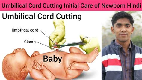 Umbilical Cord Cutting Initial Care Of Newborn Hindi Initial Care Of