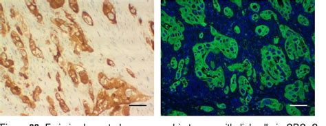 Optimization Of Immunofluorescence Protocols For Detection Of