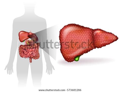 17 Cirrhosis Late Stage Royalty-Free Photos and Stock Images | Shutterstock