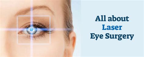 Laser Eye Surgery How It Works