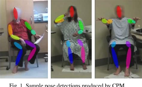 Figure 1 From Vision Based Assessment Of Parkinsonism And Levodopa