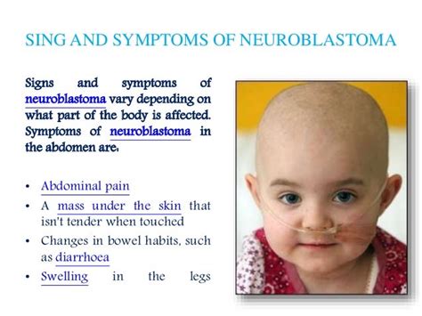 Neuroblastoma: Patient info on symptoms, diagnosis and treatment options