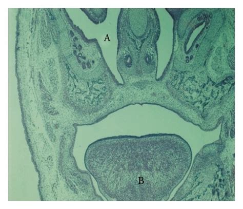 Histopathological Slides Of The Frontal Section Of The Head