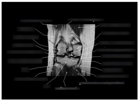 knee   diagram quizlet