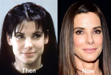 Sandra Bullock Plastic Surgery Before And After Photos