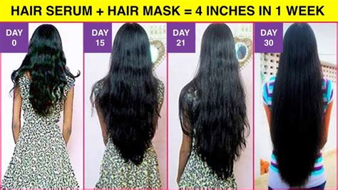 This Is How I Grew My Hair In Just 30 Days 3 Inches In 1 Week Youtube