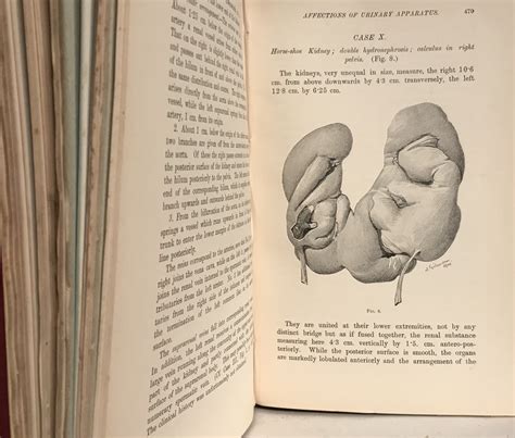 Papers Surgical And Anatomical Selected Reprinted From Various