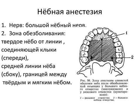 Проводниковая анестезия - презентация онлайн