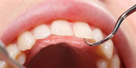 unhealthy gums increase disease risk prevention