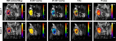 Multiparametric Renal Magnetic Resonance Imaging A Reproducibility