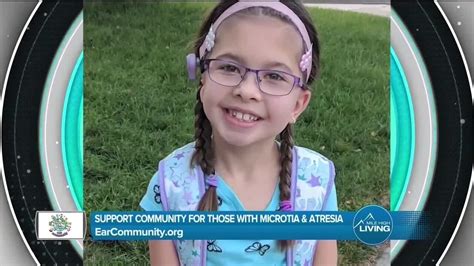 Support For Microtia Atresia Ear Community