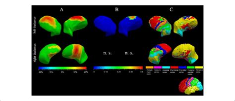 Thalamic Shape Analysis Panel A Denotes The W1 Versus W12 Group