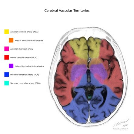 (English) VASCULAR TERRITORIES,STROKE,CEREBELLAR,BRAIN | hubstroke.com