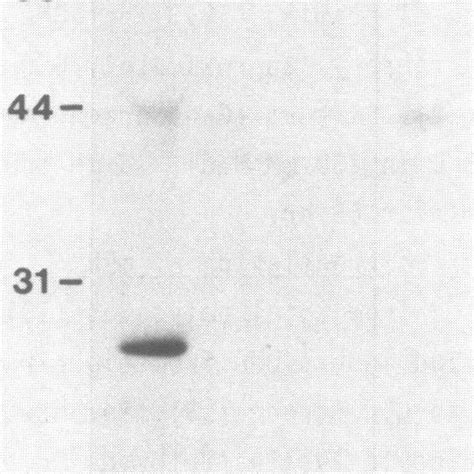 Immunoprecipitation Of 35s Methionine Labeled In Vitro Translation