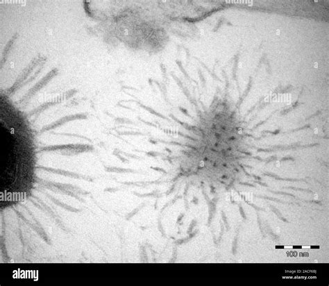 Mimivirus Transmission Electron Micrograph Tem Von Acanthamoeba Polyphaga Mimivirus Apmv