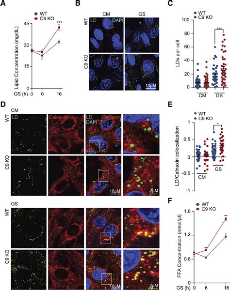 Figure 1 From A C9orf72CARM1 Axis Regulates Lipid Metabolism Under