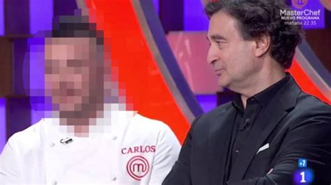 El ganador de MasterChef revela qué le pasa en la cara aMENzing