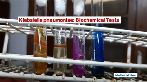 Klebsiella Pneumoniae Biochemical Tests YouTube