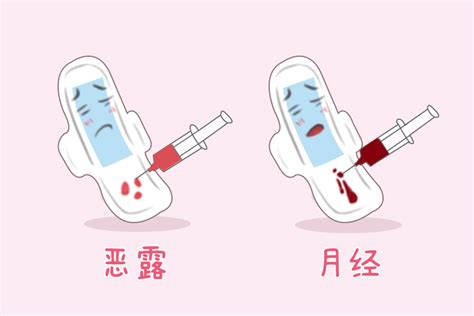 产后多久来月经才算正常？ 深圳多喜娃