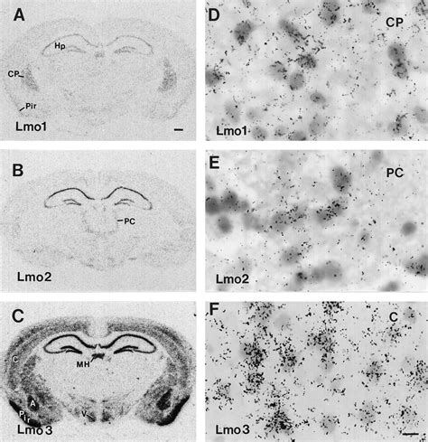 Photomicrographs Showing The Distribution Of Lmo1 A D Lmo2 B E Download Scientific