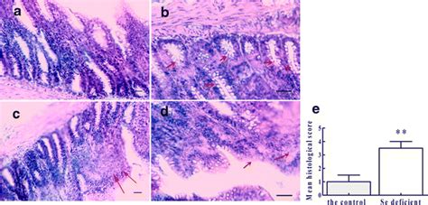 Histological Damage In The Duodenal Mucosal Tissues From Each Group