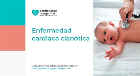 Clasificación De Cardiopatías Congénitas