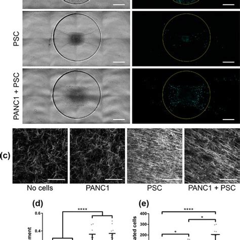 Quantification Of Collagen Fiber Alignment And Total Cells Migrated