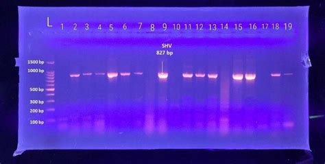 Ethidium Bromide Stained Agarose Gel Electrophoresis Of Conventional