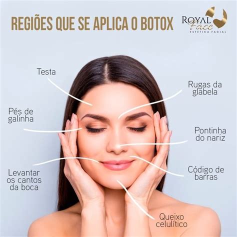 Botox For The Chin Along With 9 Information You Should Know