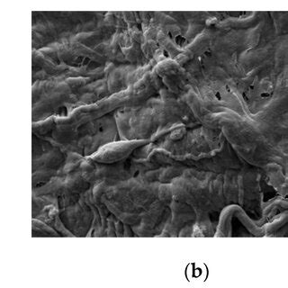 Cell decalcification detection: (a) SEM image before the treatment; (b ...