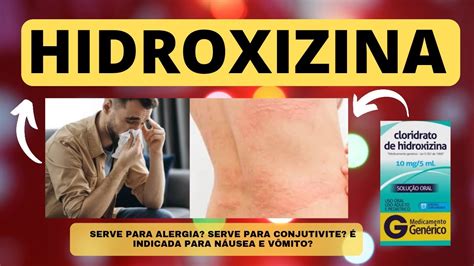 HIDROXIZINA HIXIZINE mecanismo contraindicação reações interação