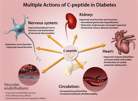 Cpeptide And The Pathophysiology Of Microvascular Complications Of