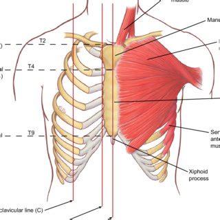 PDF Surface Anatomy And Surface Landmarks For Thoracic Surgery