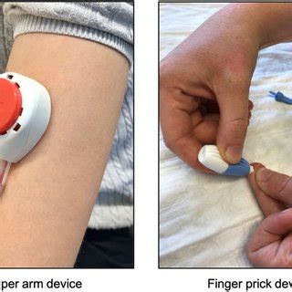 Agreement Between Capillary And Venous Blood Sampling With Respect To