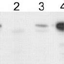 Western Blot Analysis Demonstrating Vlse Expression In Vlse