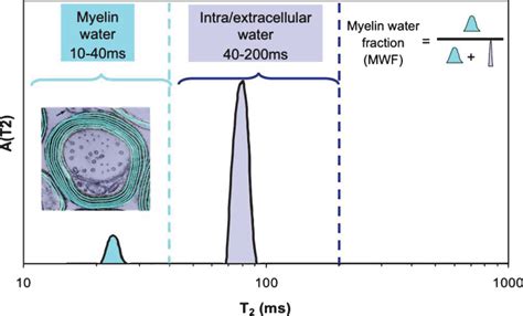 Magnetic Resonance Of Myelin Water An In Vivo Marker For Myelin PMC