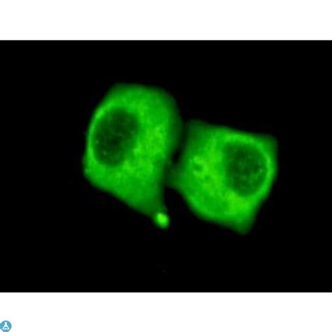 Anti Pdha Pdh E Alpha Antibody Mouse Anti Human Monoclonal Lsbio