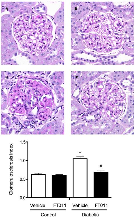 Representative Photomicrograph Of Pas Stained Sections From Diabetic