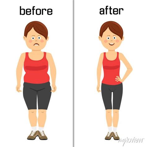 O Corpo Da Mulher Antes E Depois Da Perda De Peso Fotomural