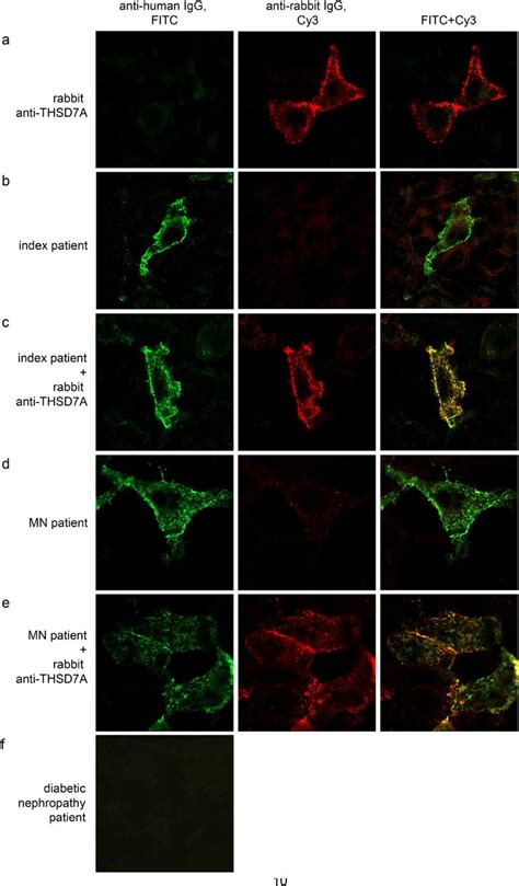 Immunofluorescence Co Staining Representative Photographs Of