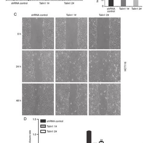 Talin1 Knockdown Inhibits The Migration And Invasion Of Hct116 Cells Download Scientific