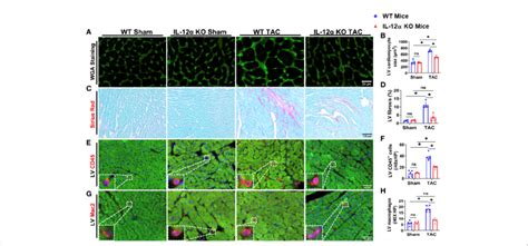 Il 12a Ko Significantly Attenuated Tac Induced Lv Cardiomyocyte