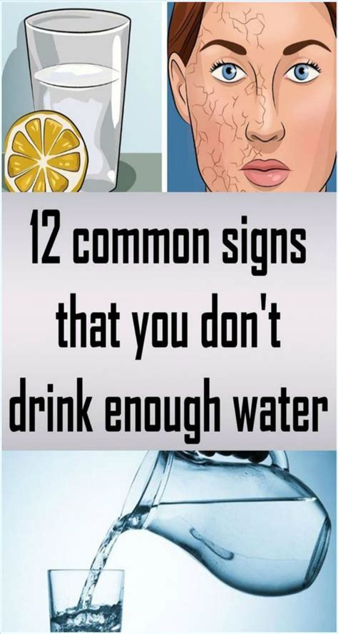 Common Signs That You Don T Drink Enough Water Vixohealth