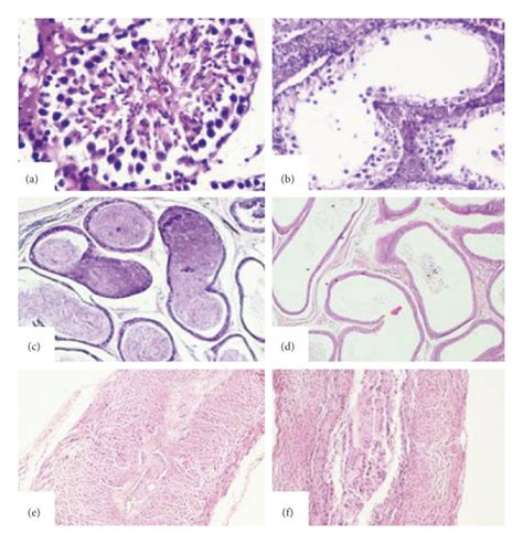 Representative Photomicrographs Of Histological Examination Day 90 Of Download Scientific