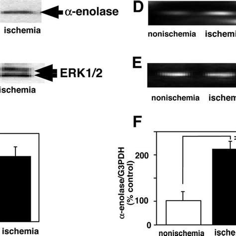 The MEK Inhibitor U0126 Completely Abolishes ERK1 2 Phosphorylation But