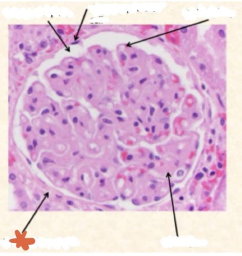 Renal Phys Flashcards Quizlet