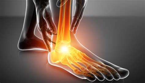 Ankle Injection A Viable Treatment For Ankle Arthritis